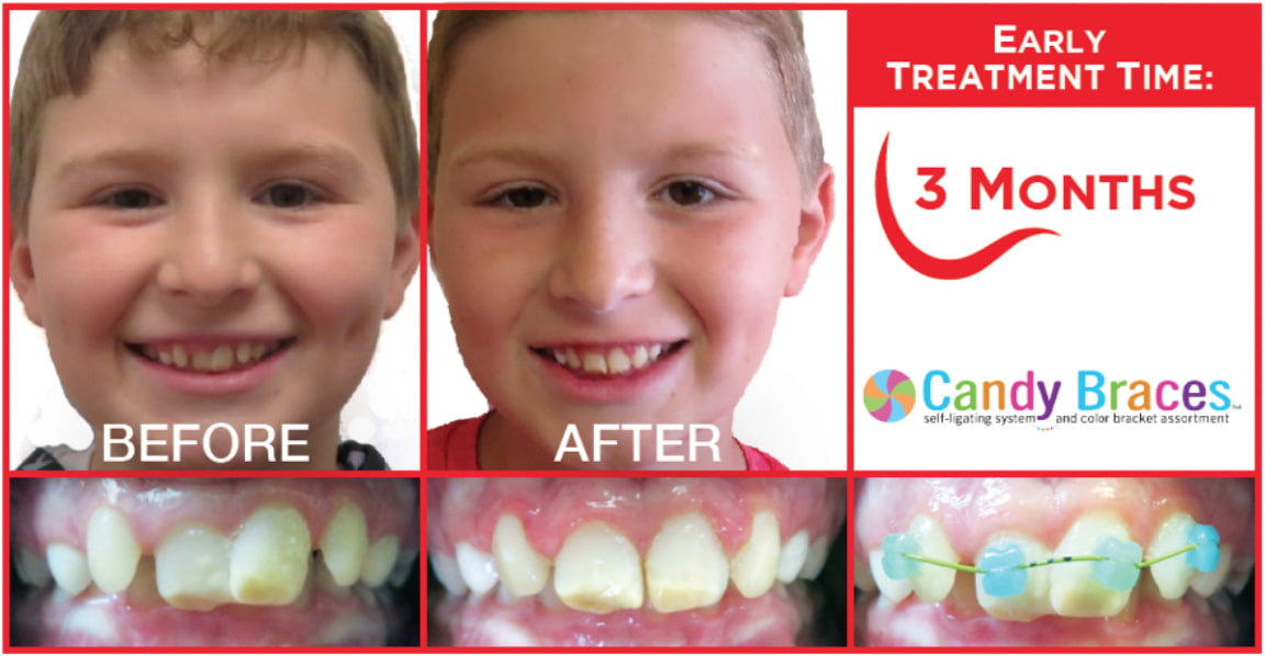 Why Choose TenBrook Orthodontics